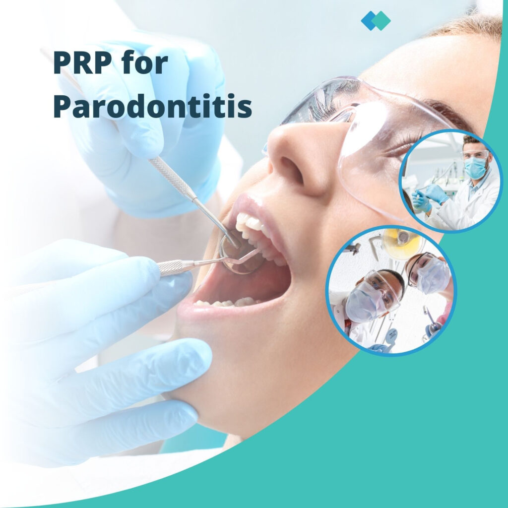 Is PRP worth When Doing the Teeth