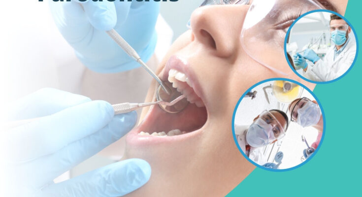 Is PRP worth When Doing the Teeth