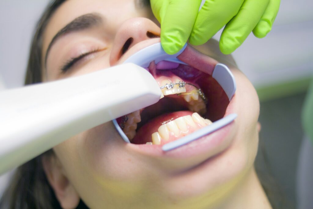 A woman receives a dental cleaning as she uses a toothbrush to maintain her oral hygiene.